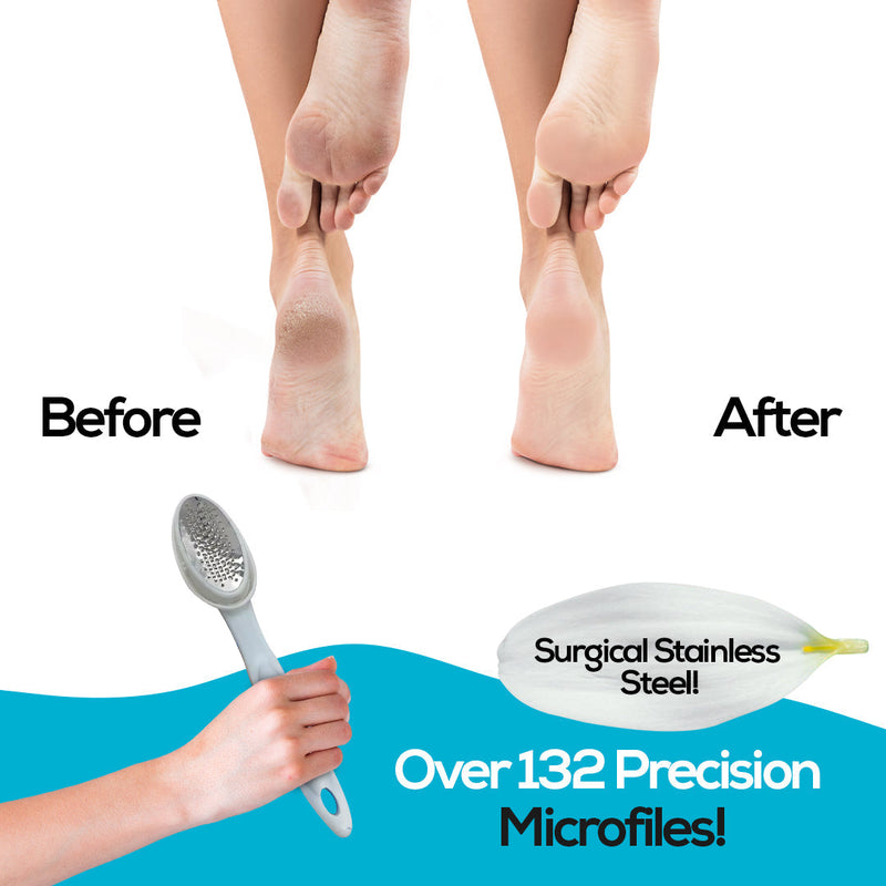 Foot Care Set - Callus Remover, Heel File & Ergonomic Handle Bu Nas L